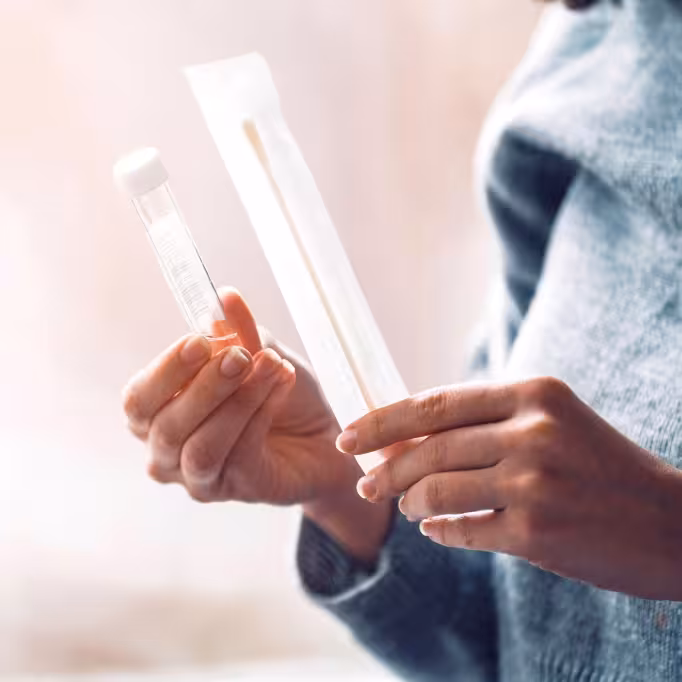 STI blood, urine and swab samples