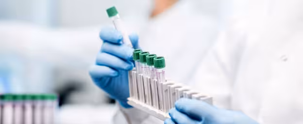 Fast result blood tests